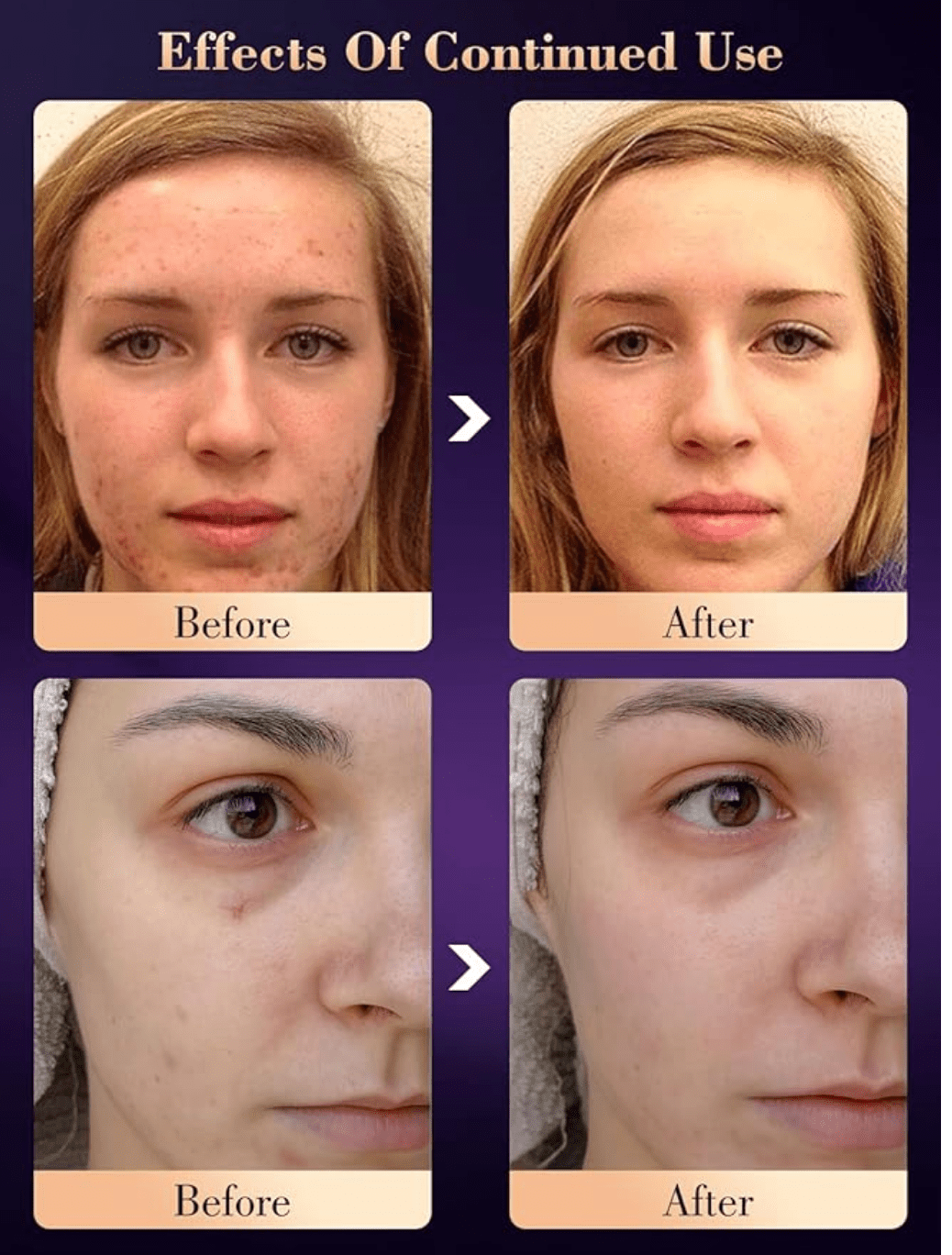 LED Face Light Therapy Mask with Spray Hydration – 7 Color Modes